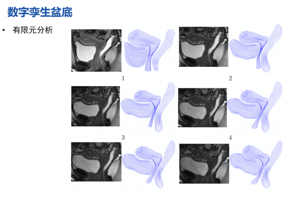 华西第二医院 · 数字盆底仿真教学系统封面